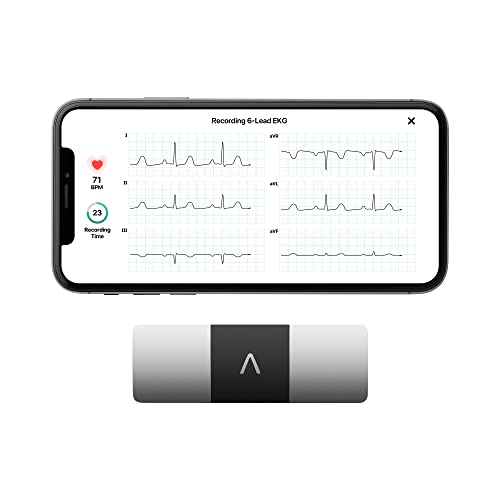 KardiaMobile 6-Lead Personal EKG Monitor – Six Views of The Heart – Detects AFib and Irregular Arrhythmias – Instant Results in 30 Seconds – Works with Most Smartphones – FSA/HSA Eligible